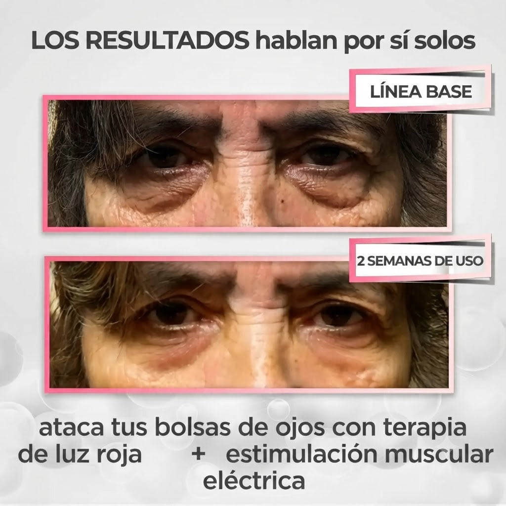 Pure Viren® 2 en 1 - terapia de luz roja + EMS para eliminar las bolsas de los ojos.