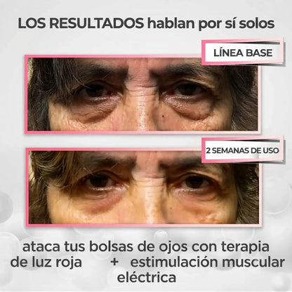 Pure Viren® 2 en 1 - terapia de luz roja + EMS para eliminar las bolsas de los ojos.