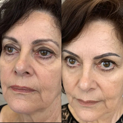 Pure Viren® 2 en 1 - terapia de luz roja + EMS para eliminar las bolsas de los ojos.