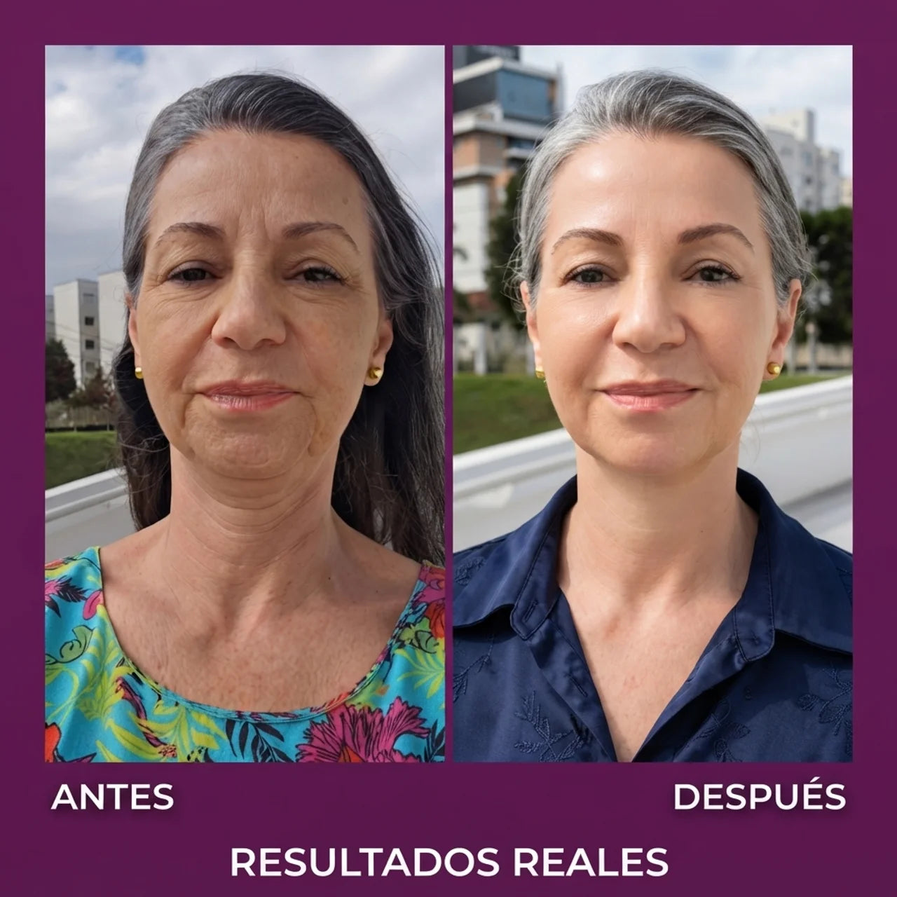 Probioderm 3D — El Lifting Coreano Nocturno